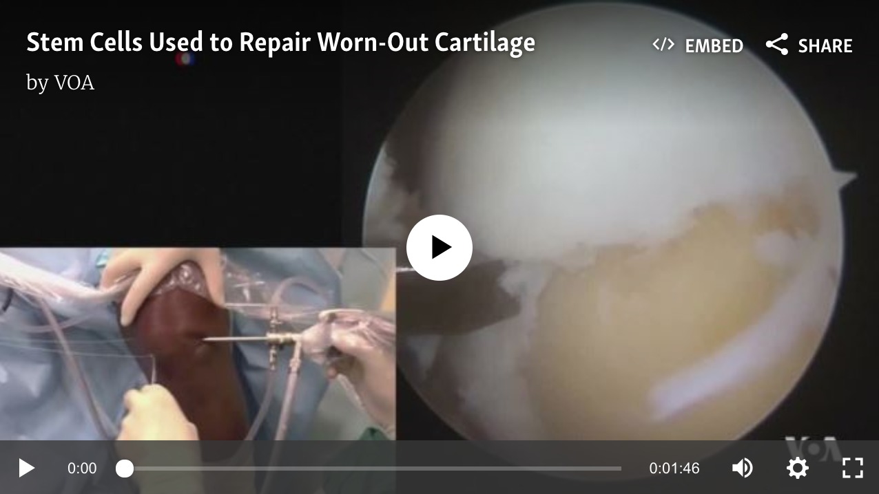 stem cells are used to repair worn-out cartilage